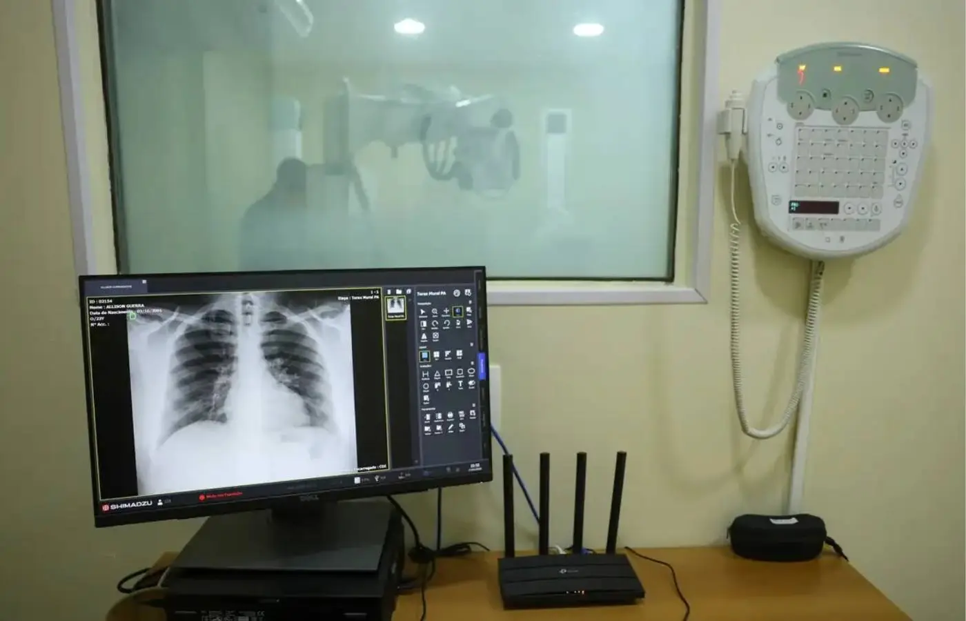 RS decreta emergência em saúde pública diante da alta de hospitalizações  por doenças respiratórias