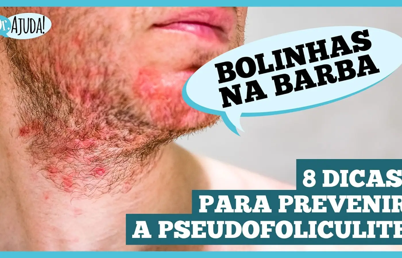 Pseudofoliculite: saiba como prevenir