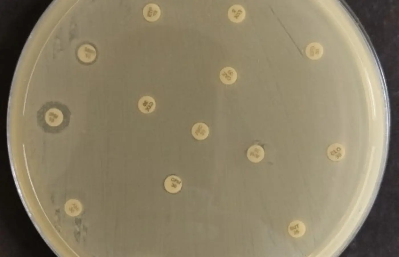 Risco global: bactéria multirresistente é encontrada em paciente ...