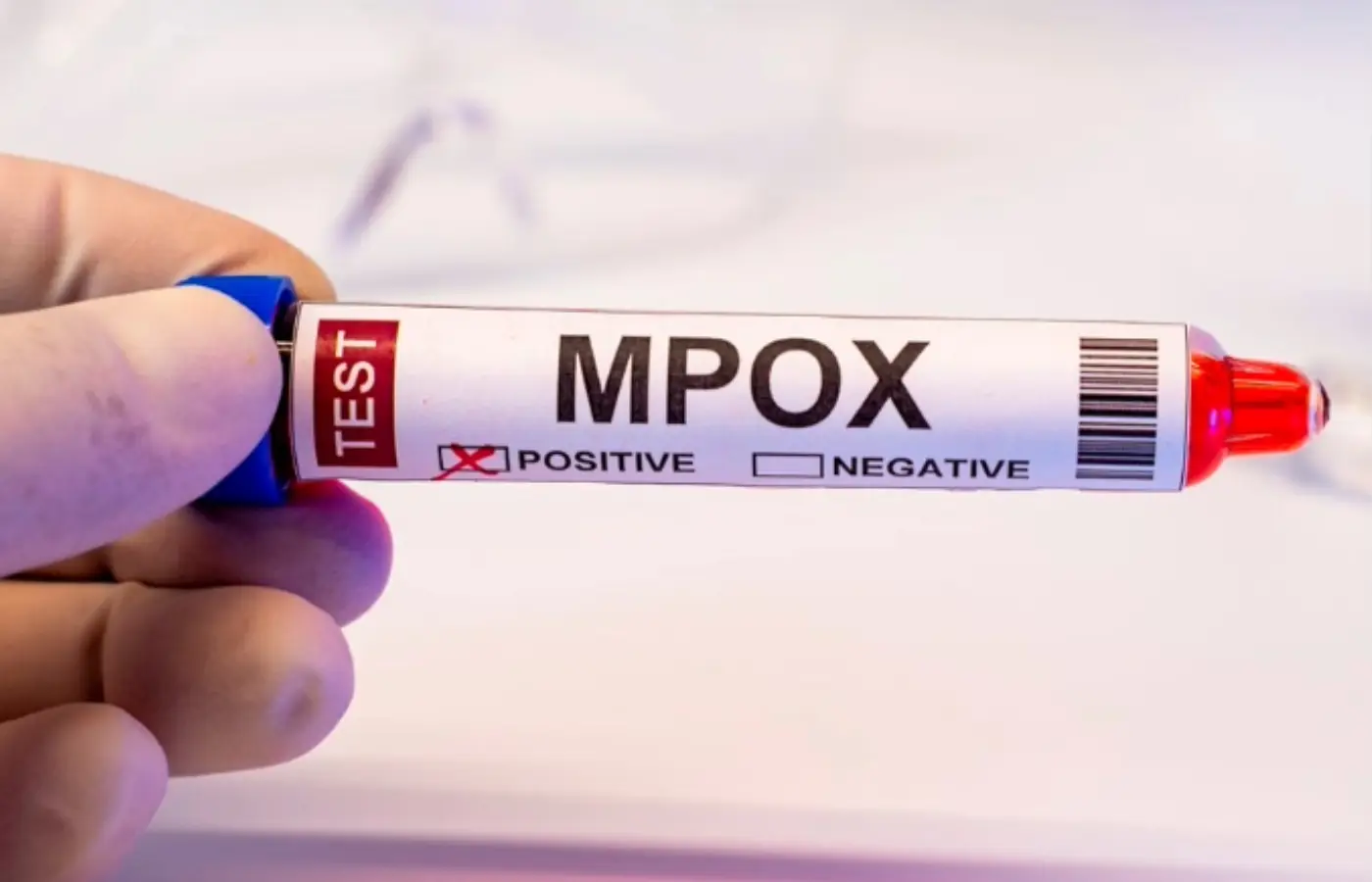 Mpox: Brasil registra 88 casos em seis estados e no DF em 2026; saiba mais sobre a doença