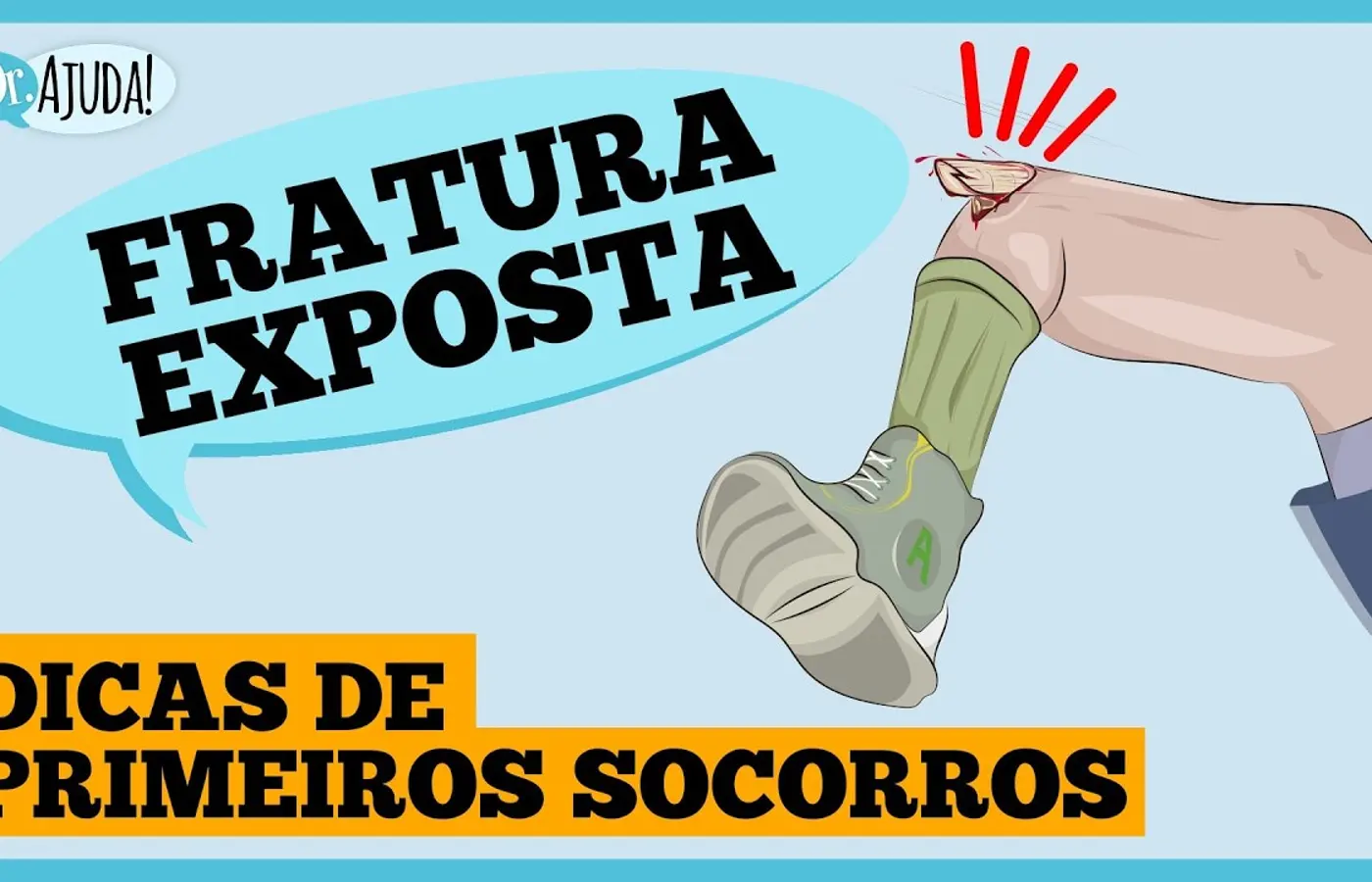 Fratura exposta: dicas de primeiros socorros