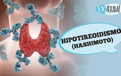 Foto: Reprodução/Canal Doutor Ajuda