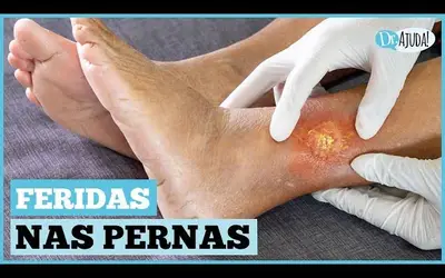  Foto: Reprodução/Canal Doutor Ajuda