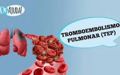 Foto: Reprodução/Canal Doutor Ajuda