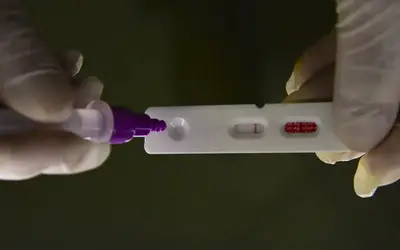 Infectolologista defende a continuidade da vacinação contra a Covid. Foto: Marcello Casal Jr/Agência Brasil