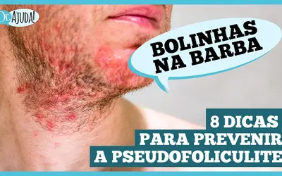 Foto: Reprodução/Canal Doutor Ajuda
