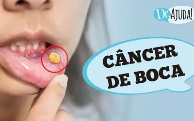 Foto: Reprodução/Canal Doutor Ajuda