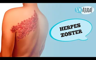 Foto: Reprodução/Canal Doutor Ajuda