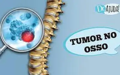 Foto: Reprodução/Canal Doutor Ajuda