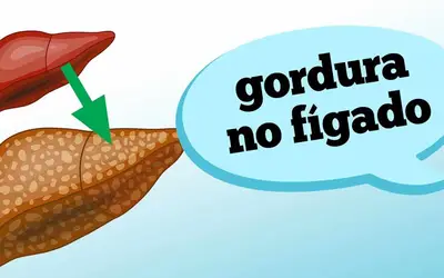 Foto: Reprodução/Canal Doutor Ajuda