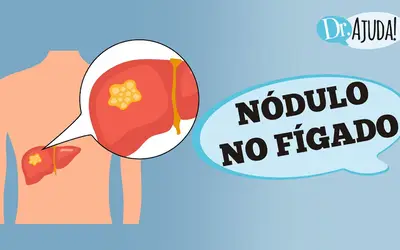 Foto: Reprodução/Canal Doutor Ajuda