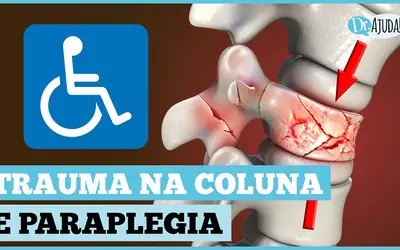 Foto: Reprodução/Canal Doutor Ajuda Foto: Reprodução/Canal Doutor Ajuda