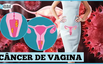 Foto: Reprodução/Canal Doutor Ajuda