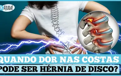 Foto: Reprodução/Canal Doutor Ajuda