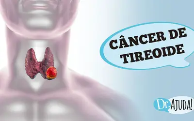 Foto: Reprodução/Canal Doutor Ajuda