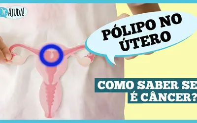 Foto: Reprodução/Canal Doutor Ajuda