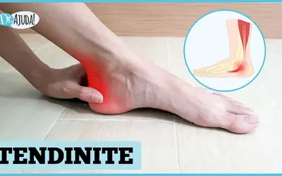 Foto: Reprodução/Canal Doutor Ajuda