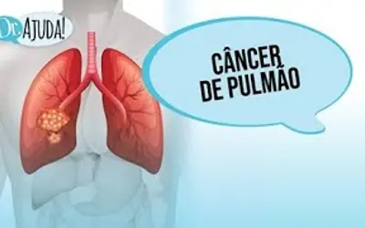 Foto: Reprodução/Canal Doutor Ajuda