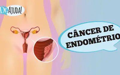 Foto: Reprodução/Canal Doutor Ajuda