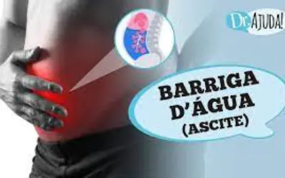 Foto: Reprodução/Canal Doutor Ajuda