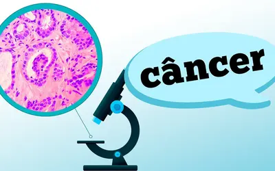 Foto: Reprodução/Canal Doutor Ajuda