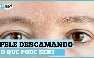 Foto: Reprodução/Canal Doutor Ajuda