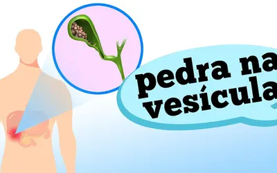 Foto: Reprodução/Canal Doutor Ajuda