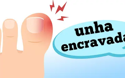 Foto: Reprodução/Canal Doutor Ajuda