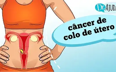 Foto: Reprodução/Canal Doutor Ajuda