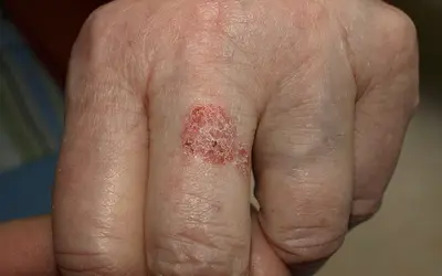 Foto: Sistema Integrado de Saúde (SIS)/Senado Federal