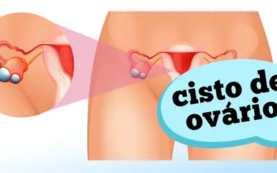 Foto: Reprodução/Canal Doutor Ajuda