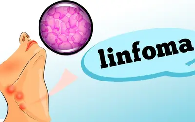 Foto: Reprodução/Canal Doutor Ajuda