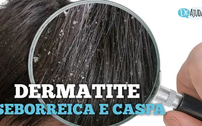 Foto: Reprodução/Canal Doutor Ajuda