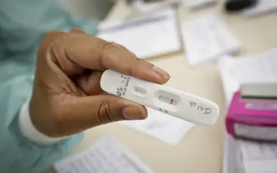 Covid: aumento de casos pode estar relacionado a variantes mais transmissíveis do vírus. Foto: Bruno Esaki/Agência Saúde-DF