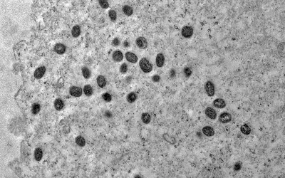 Foto: Reprodução Débora Barreto/IOC/Fiocruz