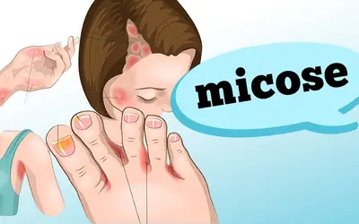 Foto: Reprodução/Canal Doutor Ajuda