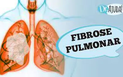 Foto: Reprodução/Canal Doutor Ajuda