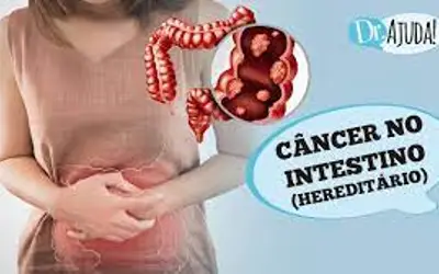 Foto: Reprodução/Canal Doutor Ajuda